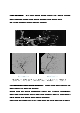 신규 간호사도 이해할 수 있게 만든 뇌동맥류 자료(시술 및 이미지)   (6 페이지)